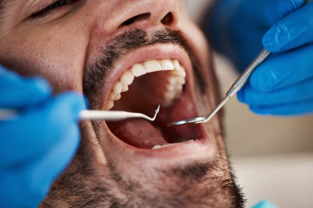 Best Wisdom Tooth Removal  in Perth Amboy, NJ